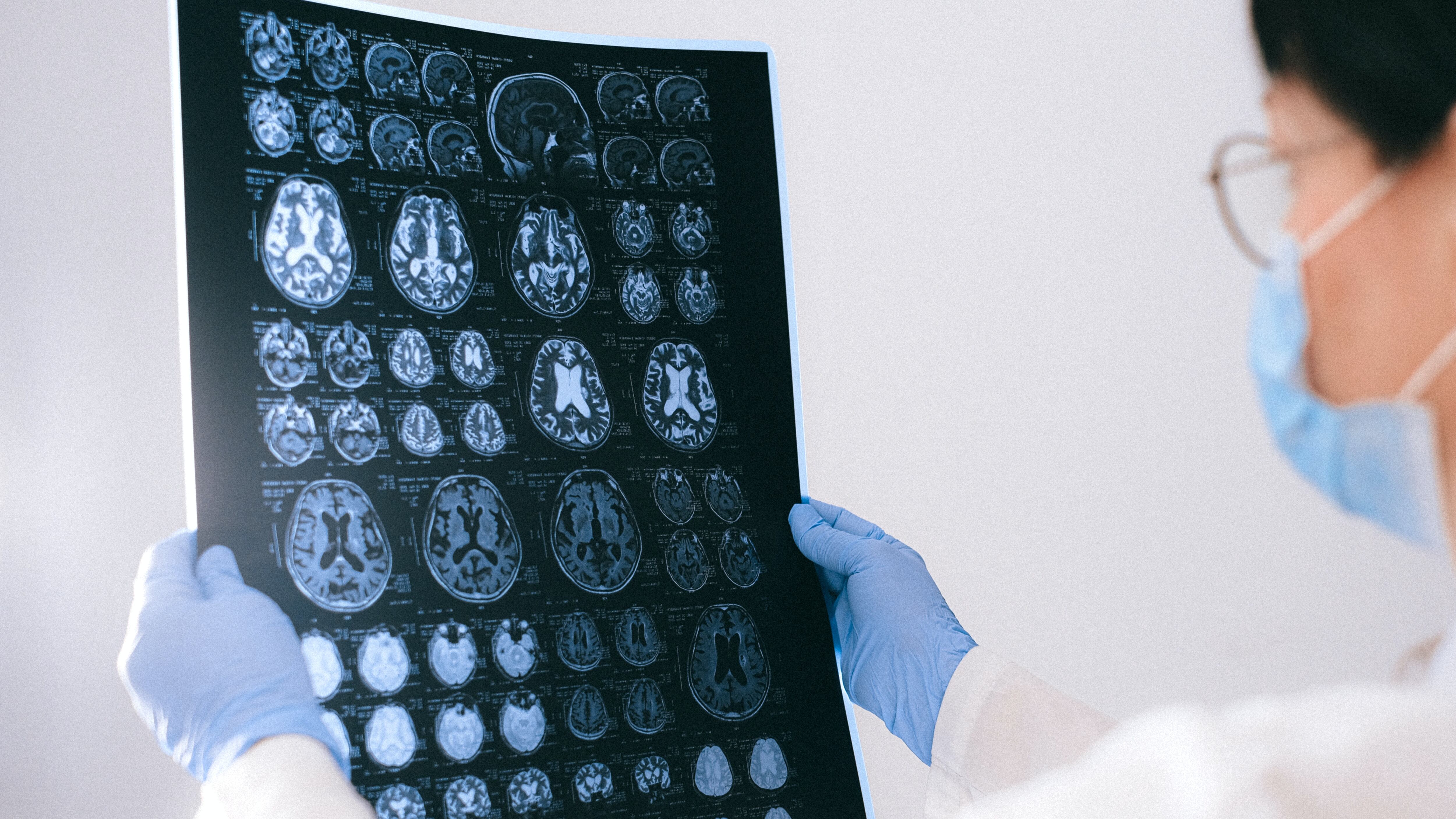 Médica analisando cérebro de paciente com Alzheimer / Pexels