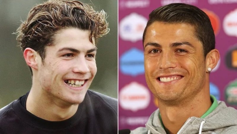 Cristiano Ronaldo antes y después